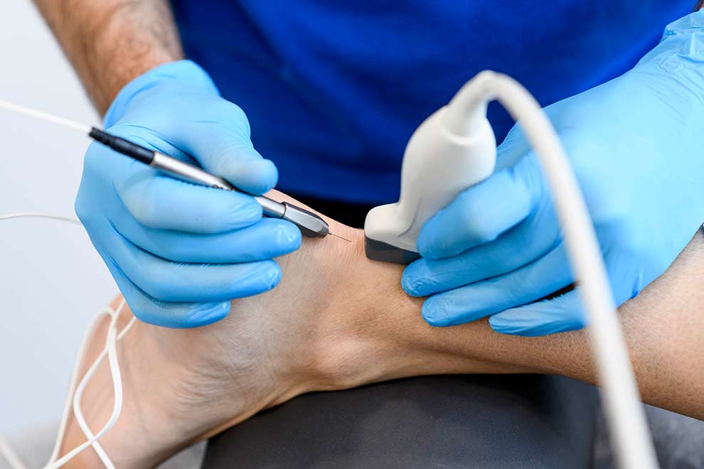 electrolisis fisiodynamic